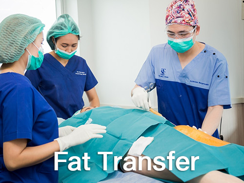 service fat transfer2