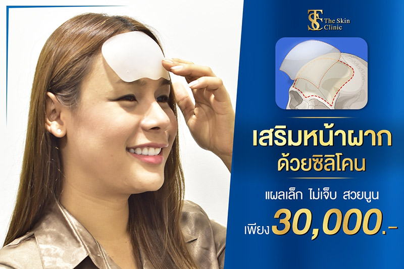 Promotion เสริมซิลิโคน ปรับรูปหน้า
