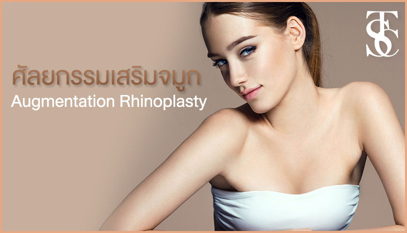 Rhinoplasty