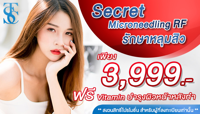 โปรโมชั่นเลเซอร์รักษาหลุมสิว